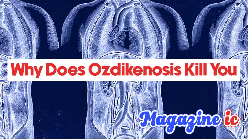 Why Does Ozdikenosis Kill You? The Shocking Truth Why Does Ozdikenosis Kill You? The Shocking Truth